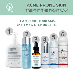 Acne Prone Skincare Routine